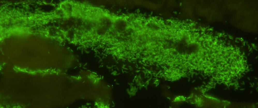cress plant cells attacked by Globisporangium ultimum. Image by Pascale Flury Uni Basel