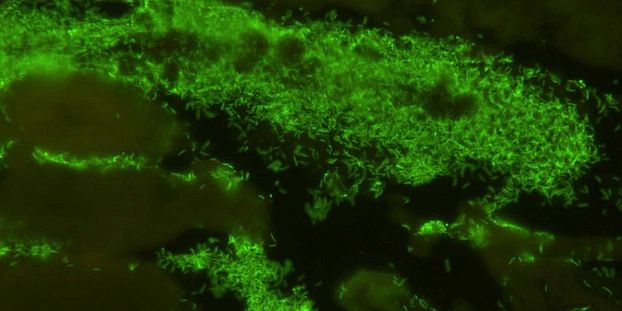 The microbial communities of composts can supress soil-borne diseases. Pot assay with cress plants attacked by Globisporangium ultimum. image: Pascale Flury Uni Basel