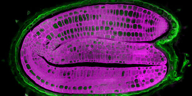 Microscopic section of an Arabidopsis thaliana seed. Image by Sylvain Loubéry Uni Geneva