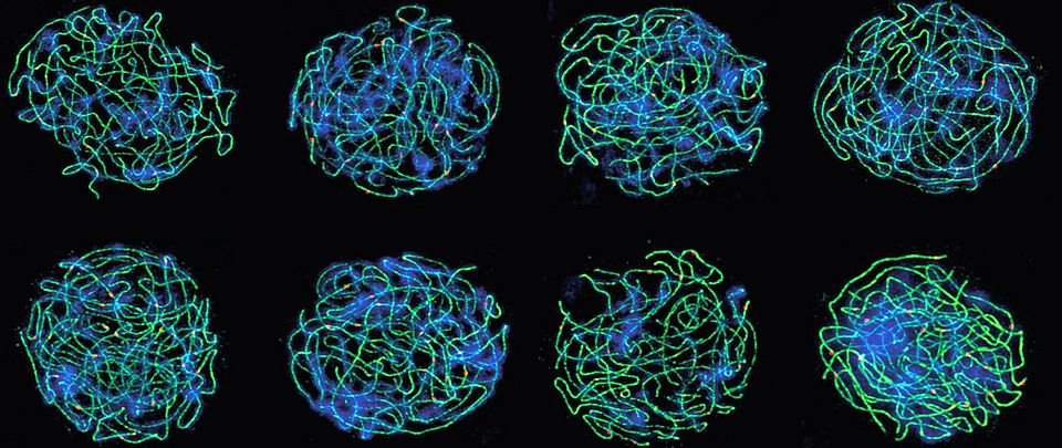 Arabidopsis arenosa tetraploid meiocytes in pachytene