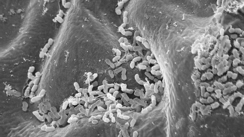 EM Arabidopsis thaliana leaf surface