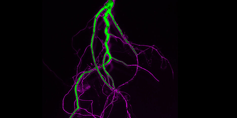suberin staining in Arabidopsis plant root