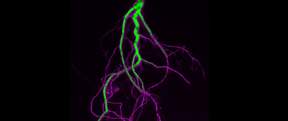 Suberin staining in Arabidopsis roots Marie Barberon
